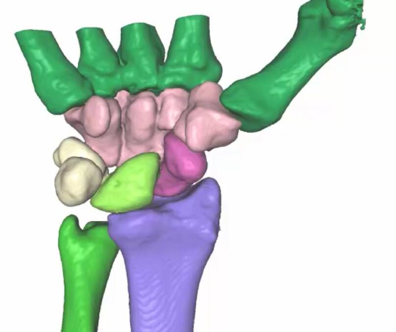 The True Life Anatomy 3D software shows the wrist. Picture Supplied