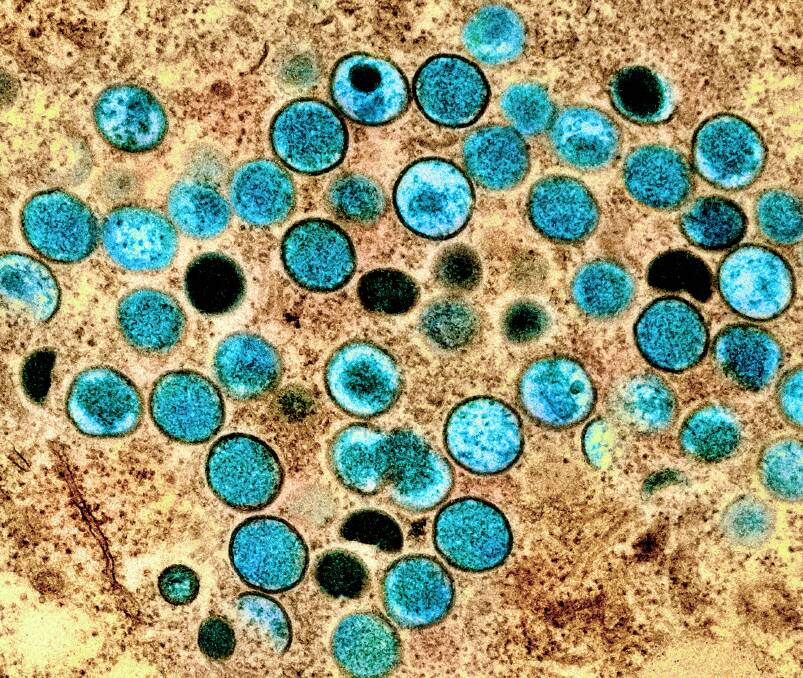 A microscope photo of mpox particles found in an infected cell. 
