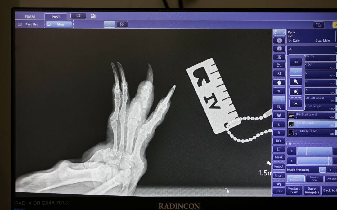 An X-ray of Kyrie's foot fracture. Picture by Jonathan Carroll