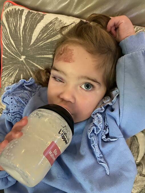 Ella is swollen and bruised after the incident. Picture supplied