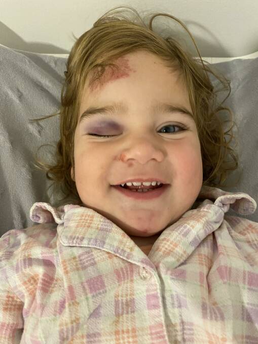 Thankfully, young Ella is still smiling through her injuries. Picture supplied