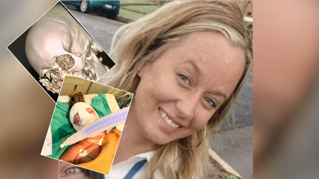 Rebecca Ode, 36, suffered multiple injuries after an accident in Bali. Pictures supplied