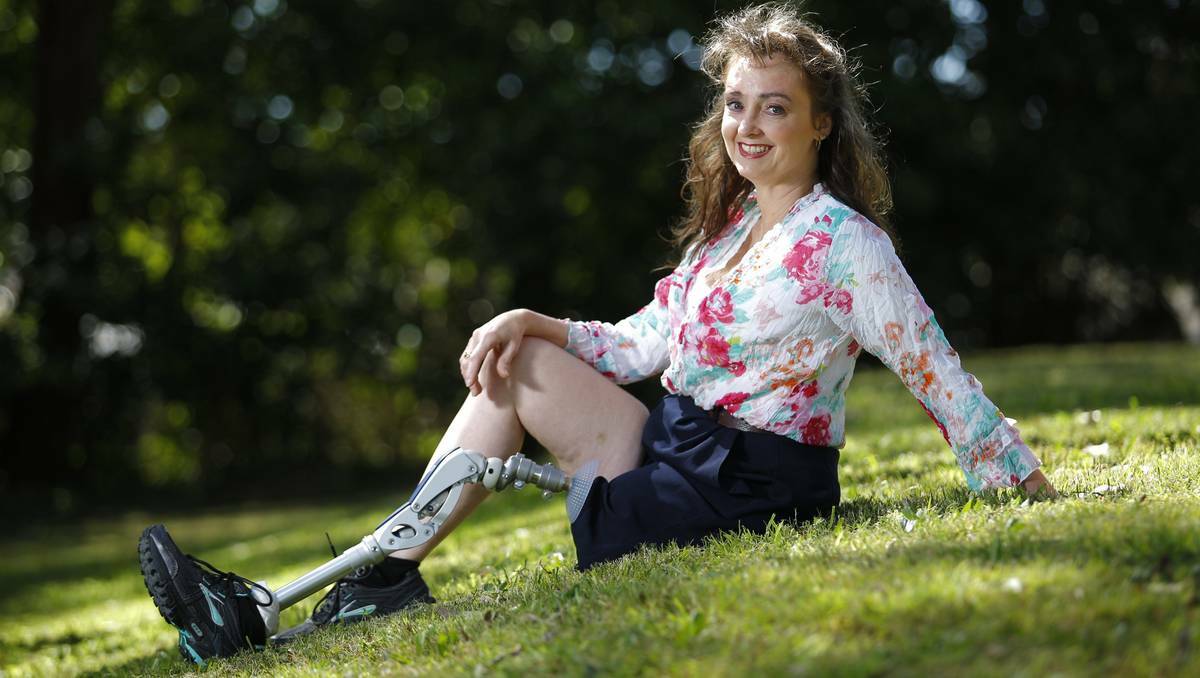 Marny Cringle with her prosthetic leg. Picture: Peter Stoop 